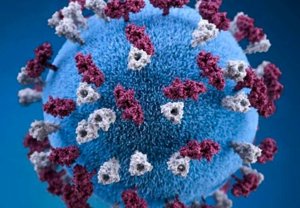 covid-19-coronavirus-covid-cell-pandemic-corona-virus-1608799-pxhere.com